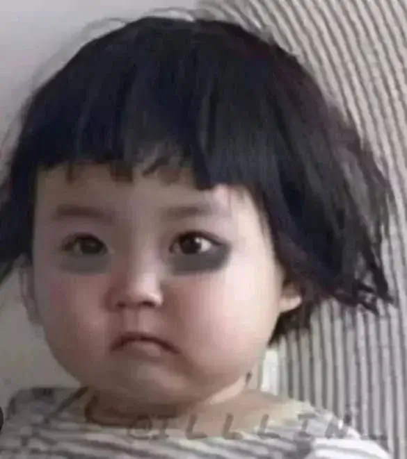 Gương mặt bé gái héo hon với vòng đen sâu hoắm Gương mặt bé gái héo hon với vòng đen sâu hoắm